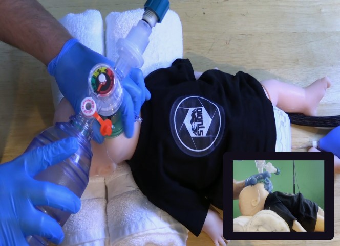 Simulated positioning of a child while preparing for an intervention