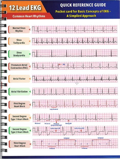 12 Lead EKG Quick Reference Guide