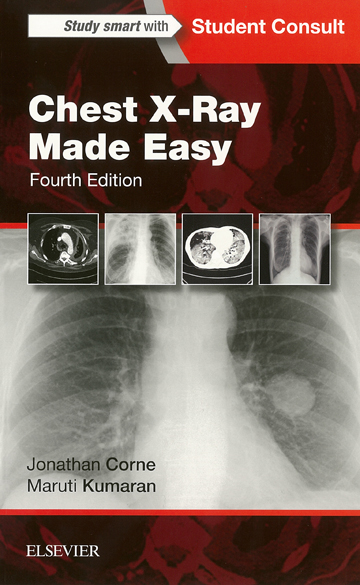 Chest X Ray Made Easy 4th Ed Aacn